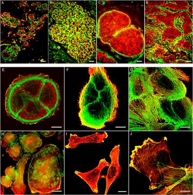 Cytoplasmic Beta and Gamma Actin Isoforms Reorganization and Regulation in Tumor Cells in Culture and Tissue